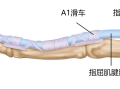 隨州市中心醫(yī)院【特色技術(shù)】超聲引導小針刀松解術(shù) 告別“扳機指”困擾