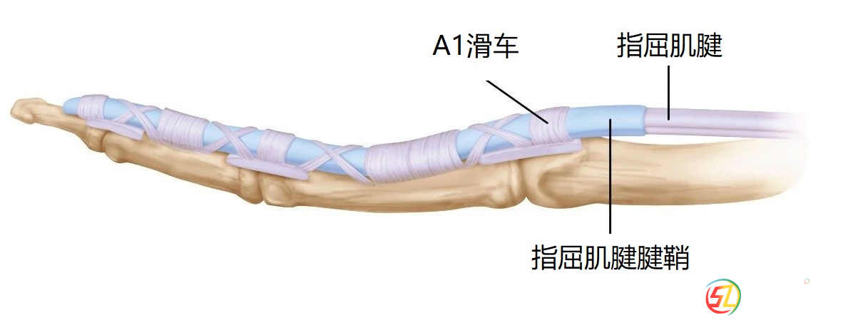 隨州市中心醫(yī)院【特色技術(shù)】超聲引導(dǎo)小針刀松解術(shù) 告別“扳機(jī)指”困擾